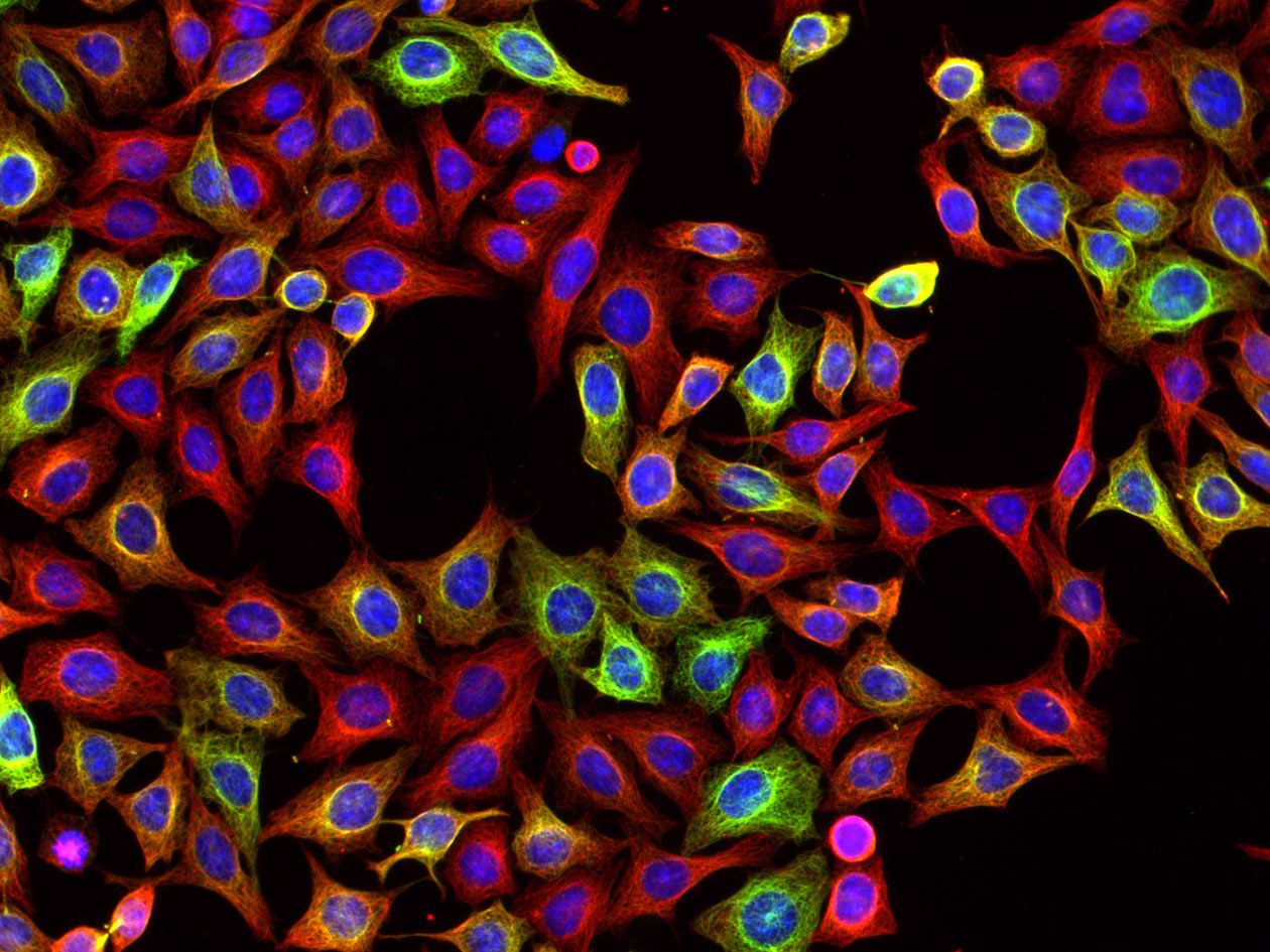 <hr>Immunomarquage de microtubules tyrosinés et détyrosinés dans des cellules HeLa.