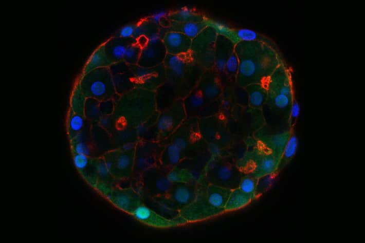 <hr>Organoïde de foie. © Inserm, NuMeCan, A. Corlu.