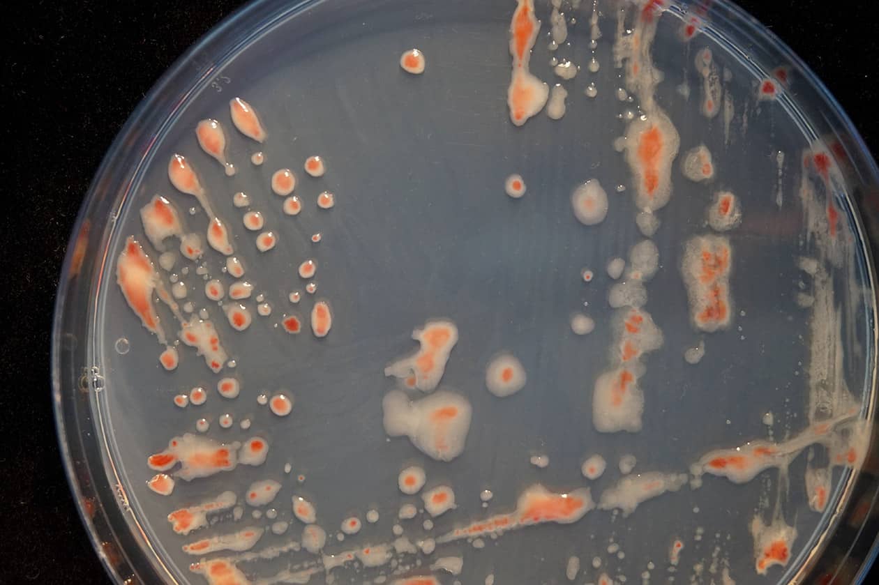 <hr>Souche de Ralstonia solanacearum sur boite de Petri. © INRAE, P. Portier.