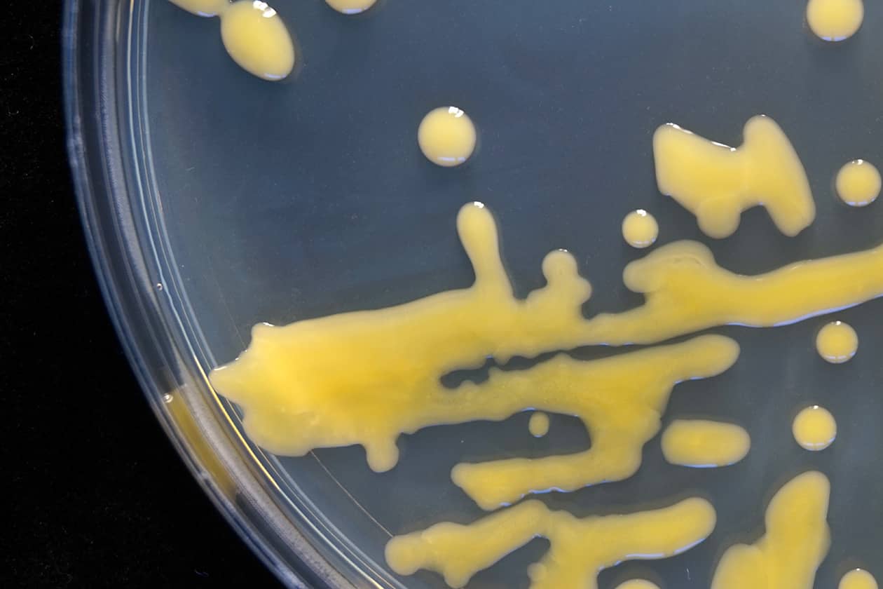 <hr>Souche de Clavibacter michiganensis sur boite de Petri. © INRAE, P. Portier.