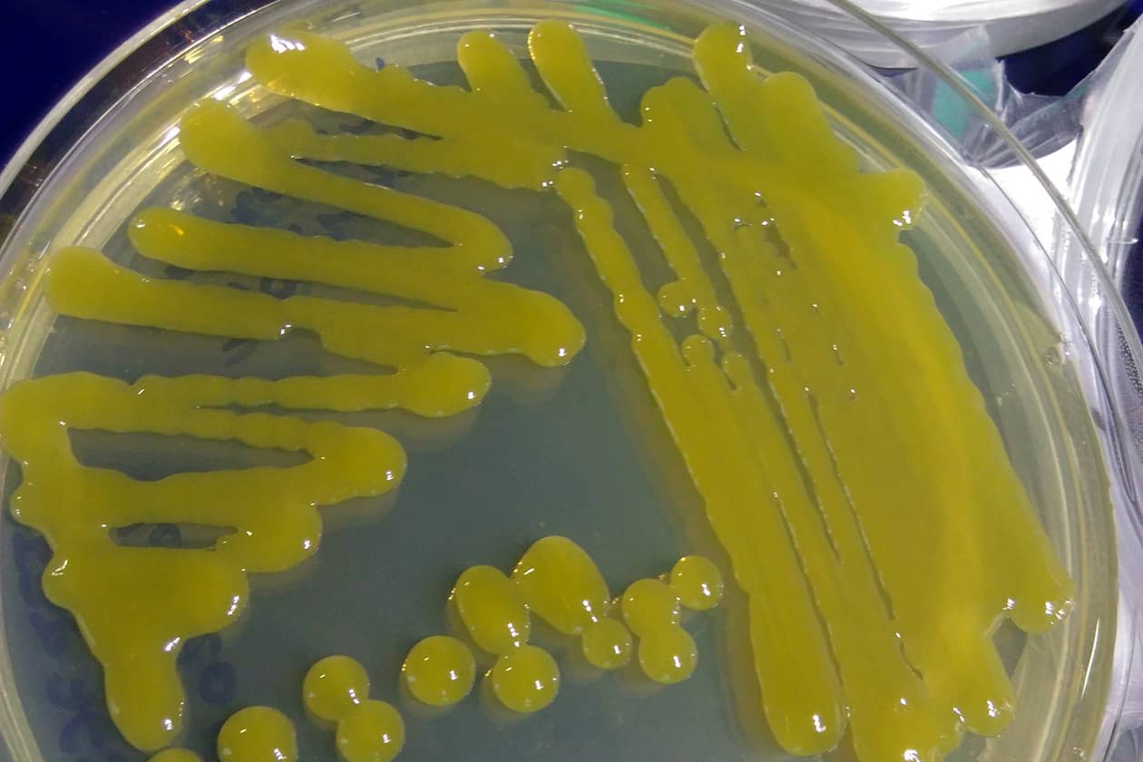 <hr>Souche de Xanthomonas arboricola sur boite de Petri. © INRAE, P. Portier.
