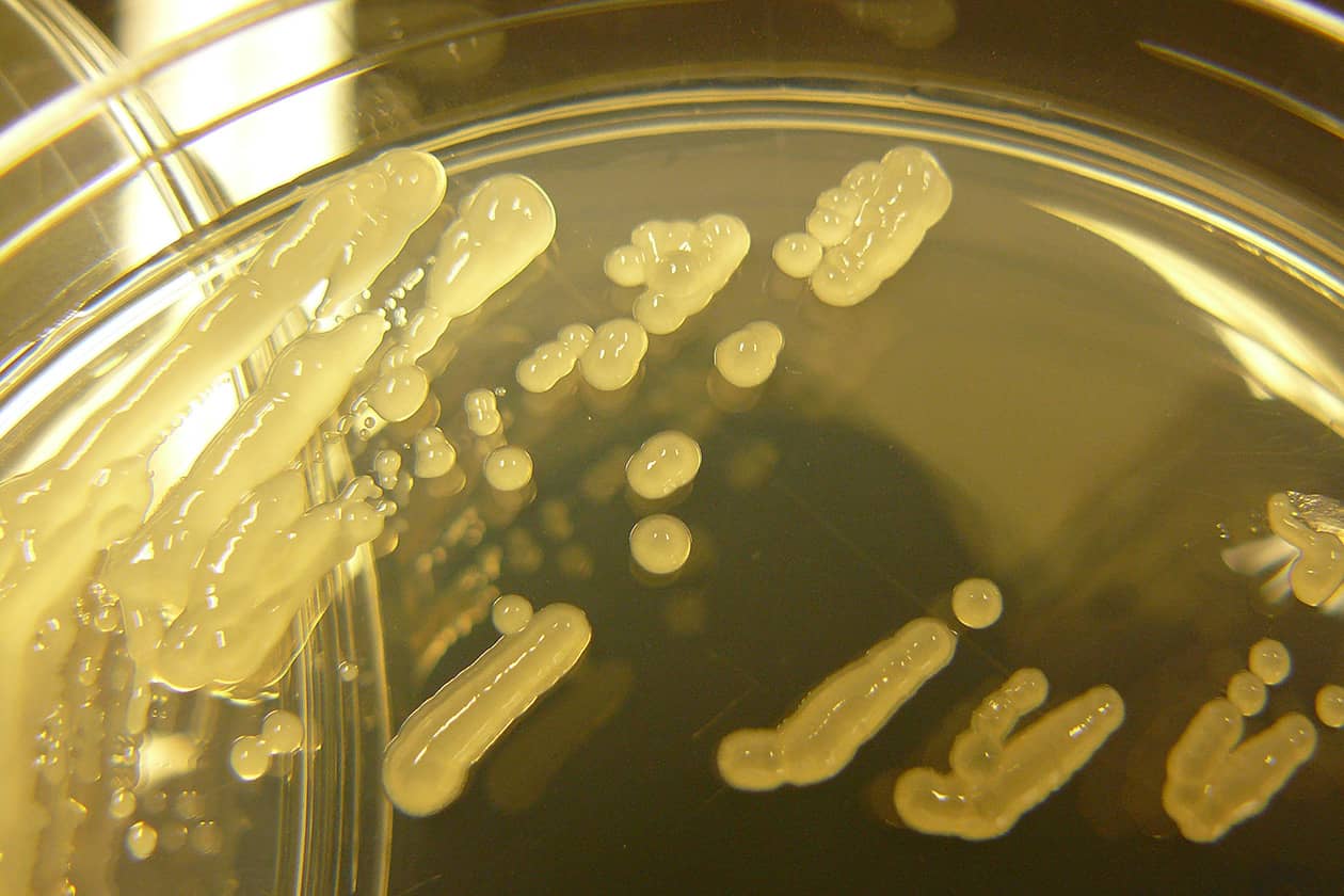 <hr>Souche de Pseudomonas syringae sur boite de Petri. © INRAE, P. Portier.