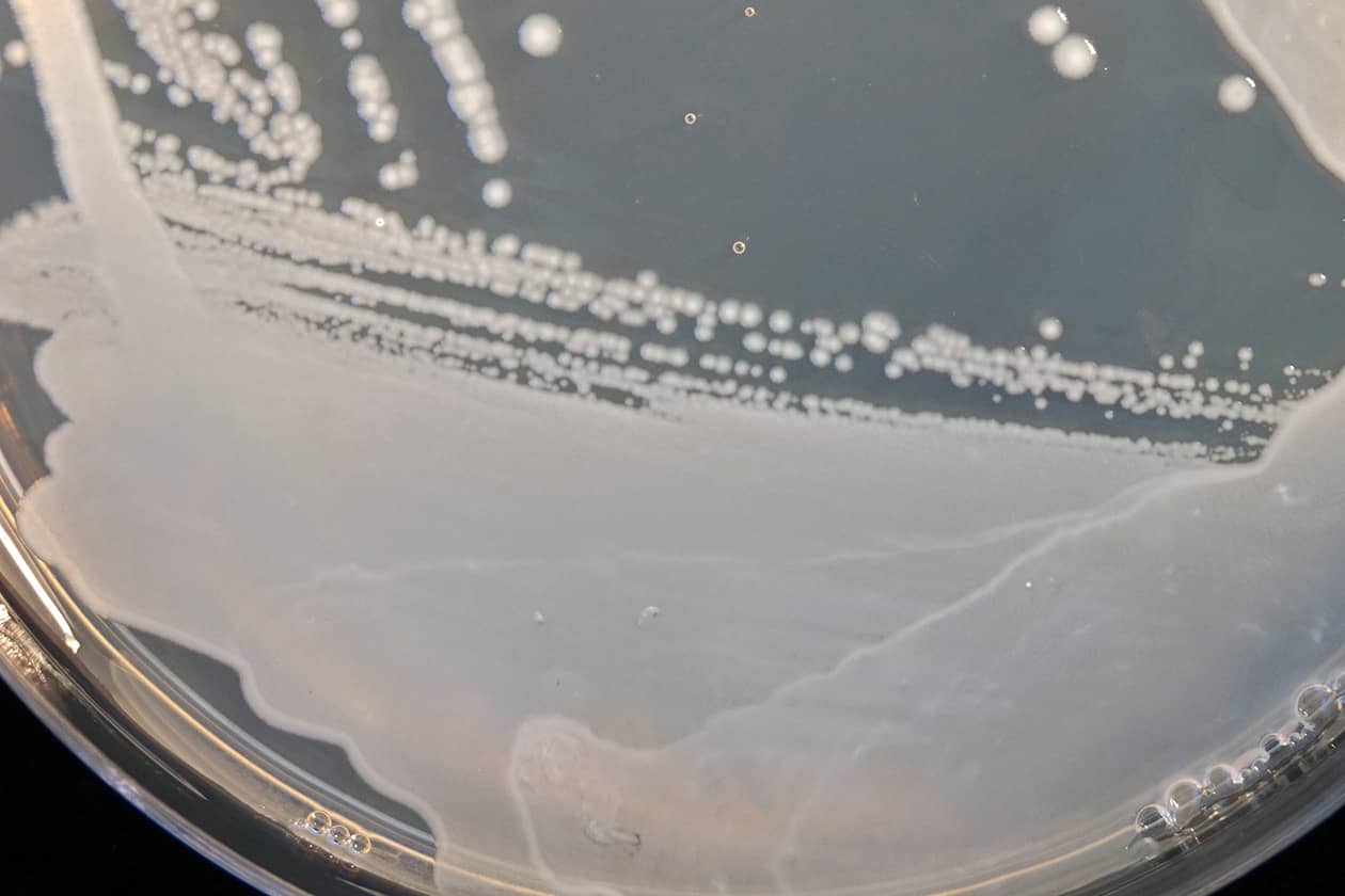 <hr>Souche de Pectobacterium atrosepticum sur boite de Petri. © INRAE, C. Dutrieux, A. Lathus.