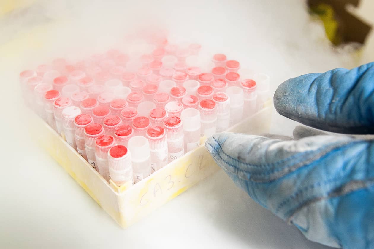 <hr>Boite de cryotubes contenant des fragments de tissus sains et tumoraux conservés sous azote liquide.