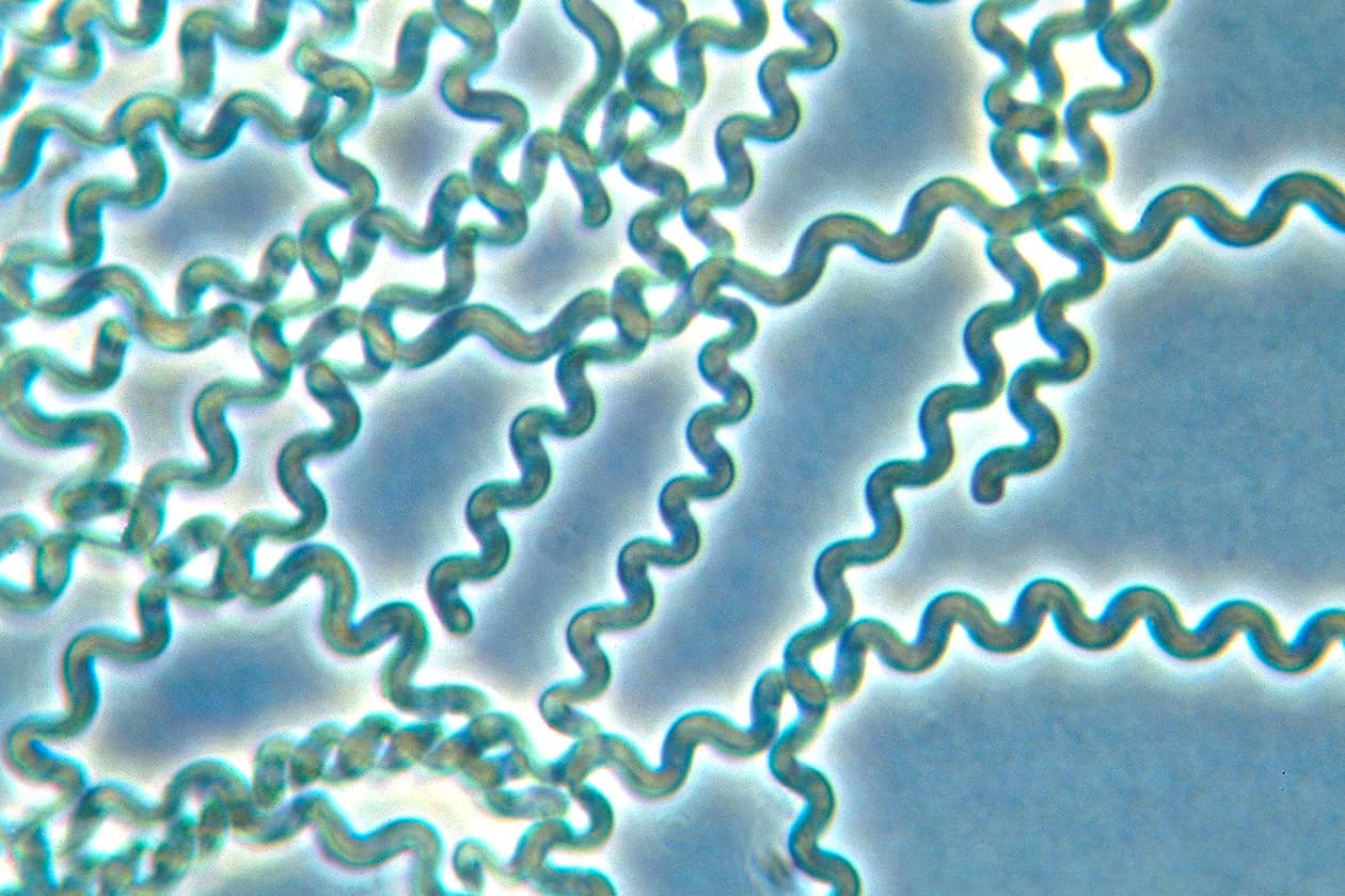 <hr>Souche de cyanobactérie Cyanothece (PCC 9318) conservée au sein de la collection PCC. © Institut Pasteur.