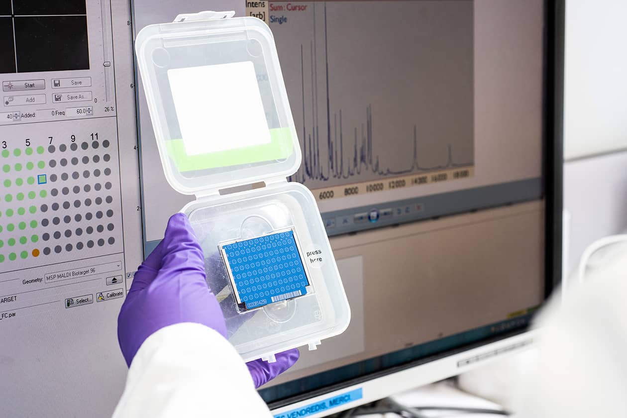 <hr>MALDI-TOF/MS Biotyper. © Institut Pasteur.