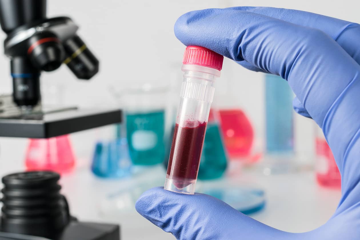 <hr>Préparation d’un échantillon de sang total pour des études génétiques. ©Karubiotec, CHU de Guadeloupe.