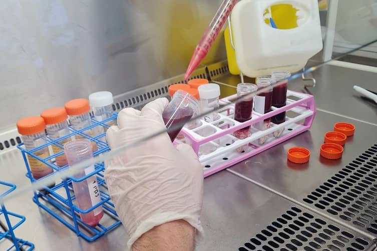 <hr>Extraction de PBMC.