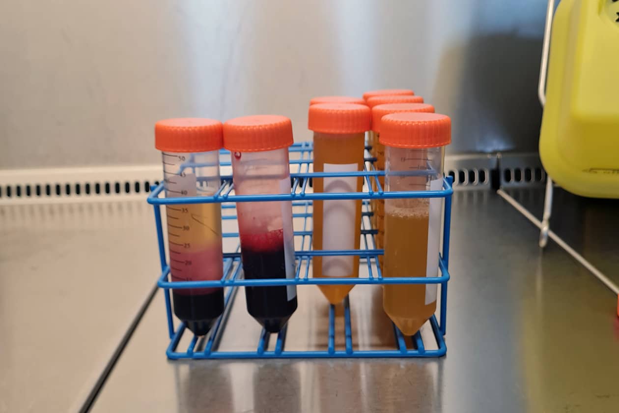 <hr>Séparation de cellules sur gradients de densité.