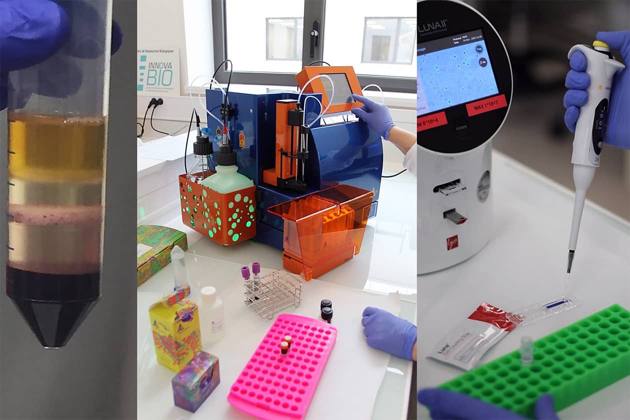 <hr>Isolement de PBMC à partir du sang périphérique avec différentes méthodes. La viabilité des cellules est systématiquement mesurée avant congélation.