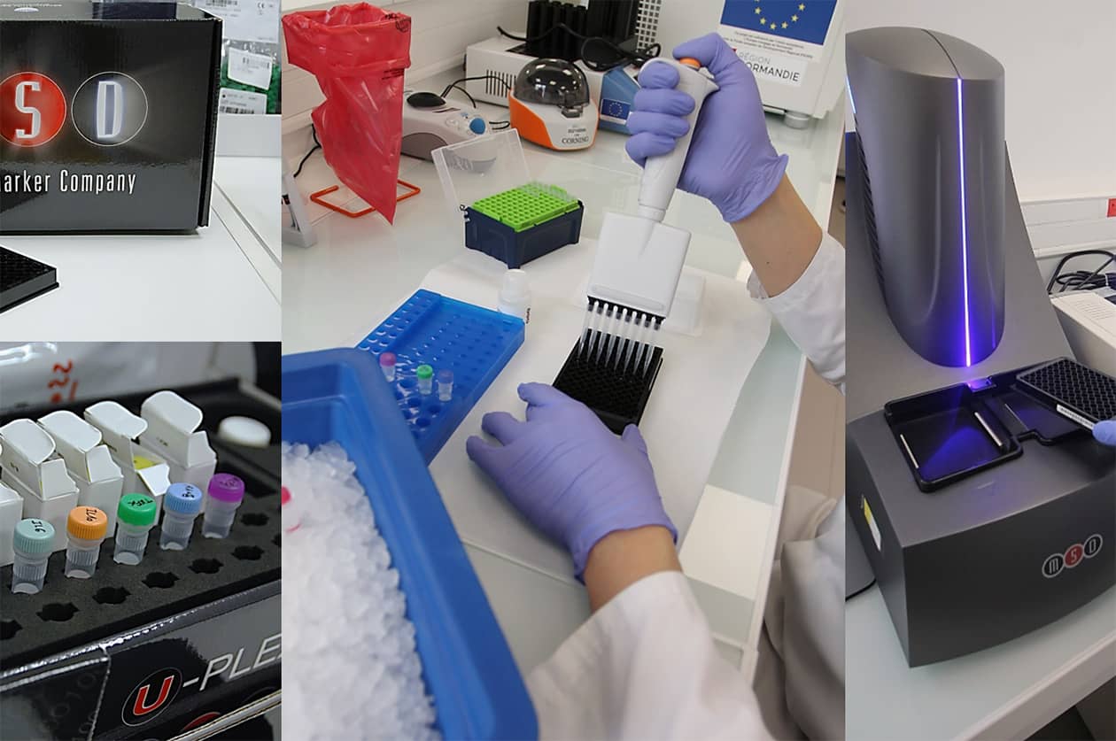 <hr>En dehors de son périmètre de certification, le CRB propose aussi des dosages multiplexes hautement sensibles grâce à la technologie Meso Scale Discovery.
