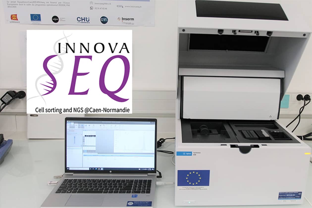<hr>Le CRB InnovaBIO effectue le contrôle qualité des acides nucléiques obtenus après extraction avec les équipements de dernière génération proposés par la plateforme InnovaSEQ.