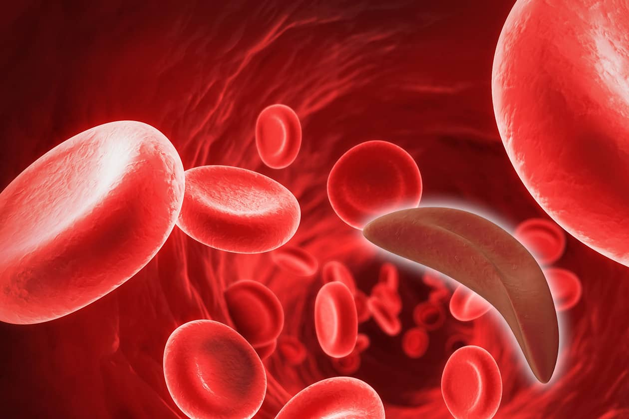 <hr>Le CRB s'intéresse aussi à la drépanocytose, maladie génétique qui affecte les globules rouges.