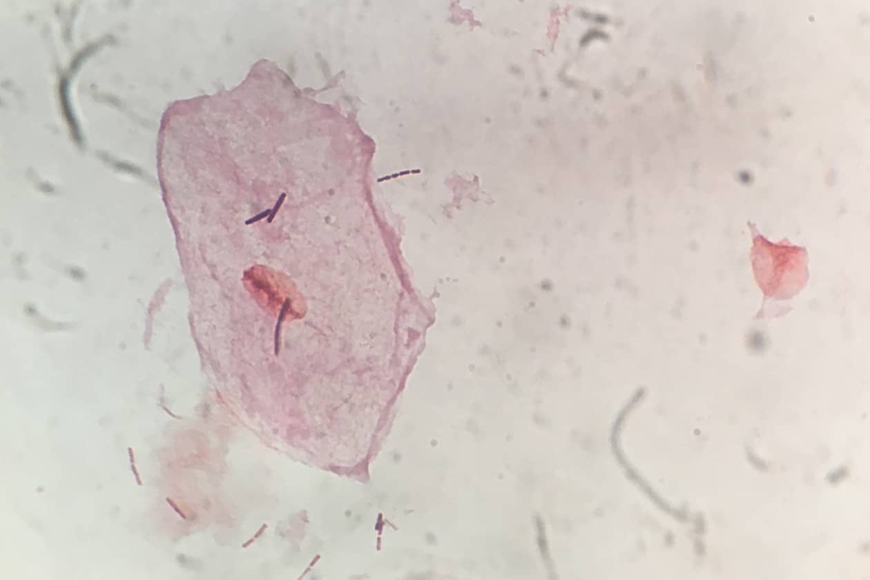 <hr>Cellules vaginales à l’état frais.