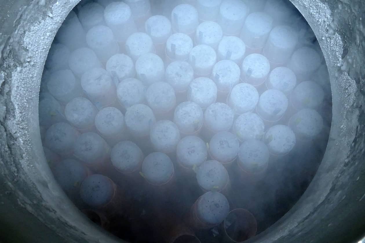 <hr>Echantillons biologiques stockés sous vapeur d’azote.