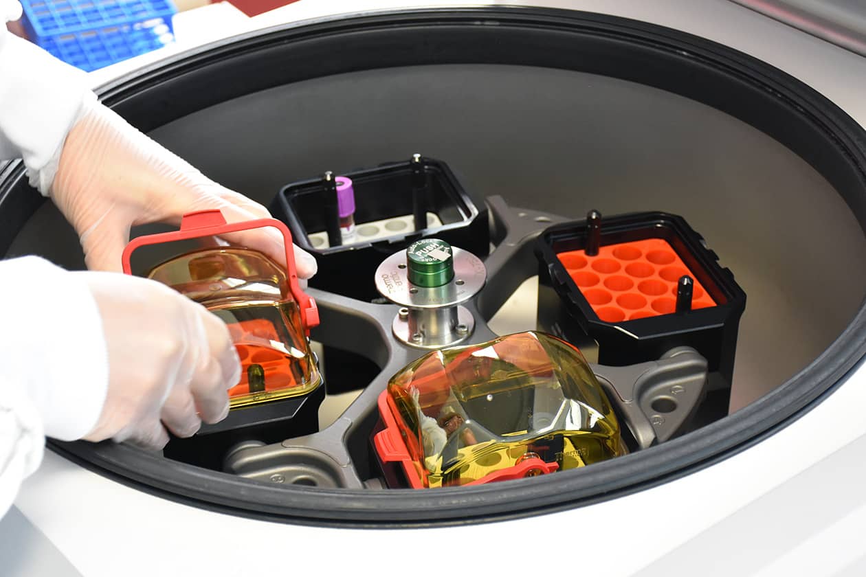 <hr>La centrifugation permet par exemple de séparer les hématies, les leucocytes et le plasma d’un prélèvement sanguin.