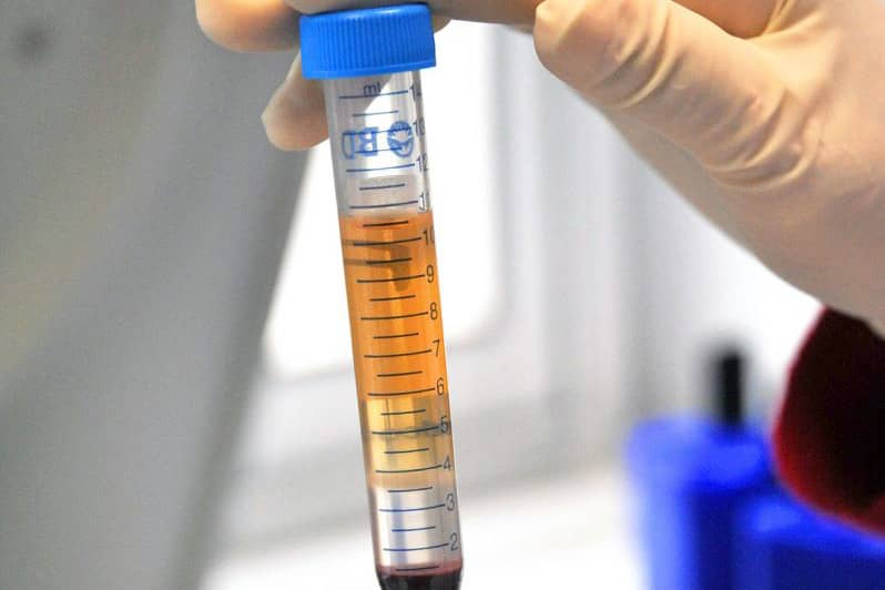 <hr>Le CRB a développé une solide expertise dans la préparation d'échantillons pour les projets.