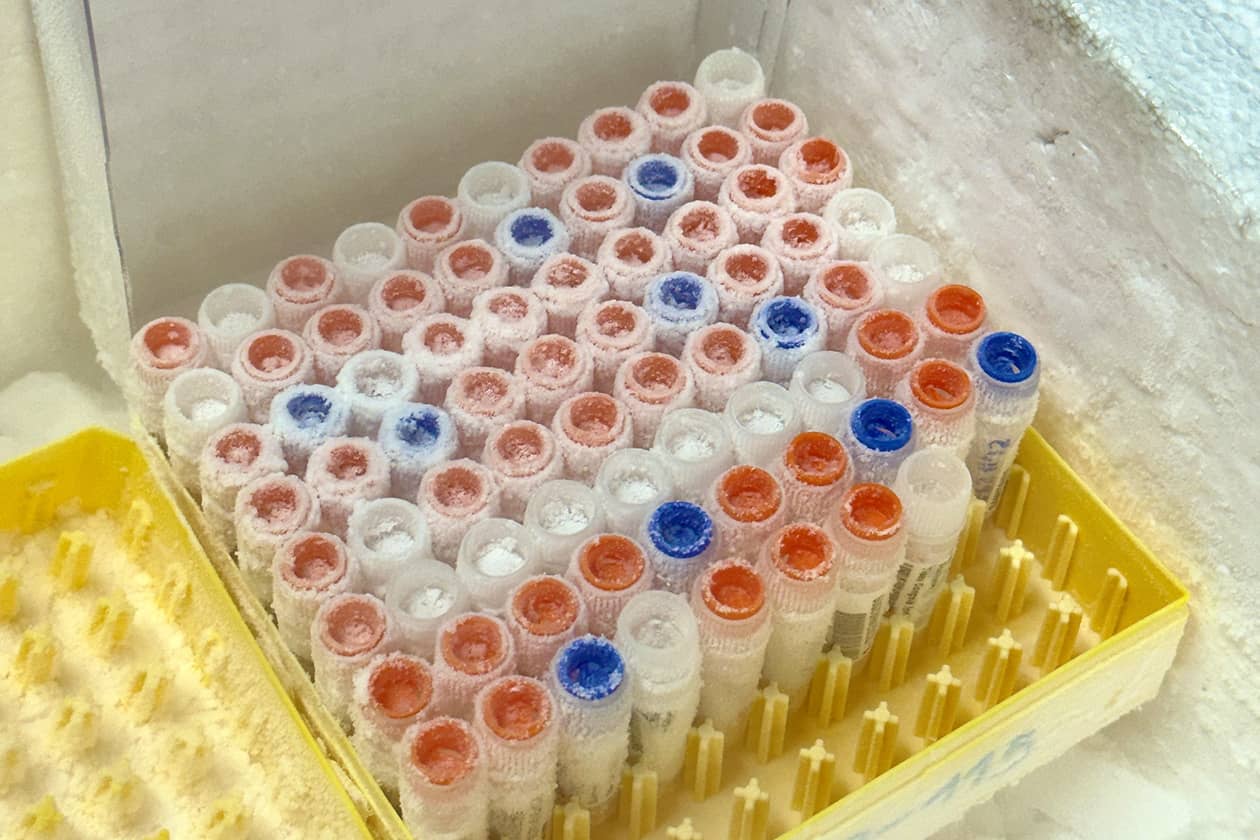 <hr>Ressources biologiques humaines.