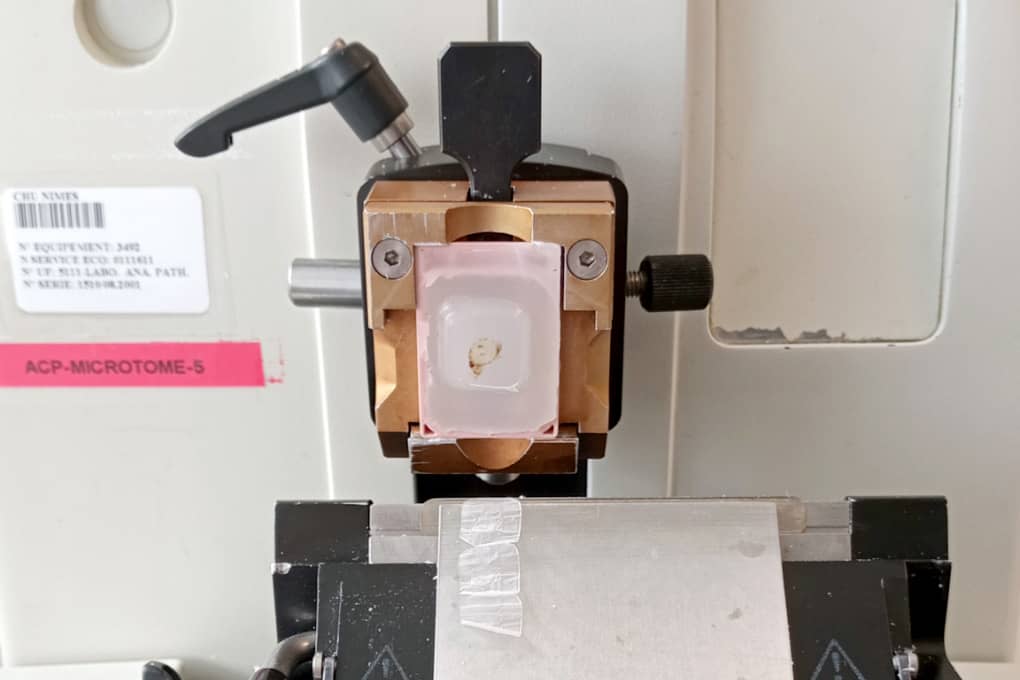 <hr>Coupe d’un bloc de paraffine au microtome.