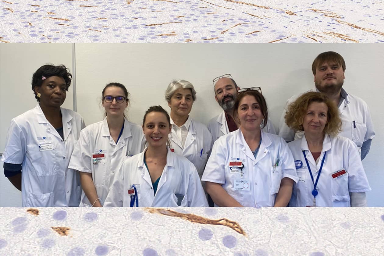 <hr>Équipe médicale du service d’hépatologie du GHPSSD.
