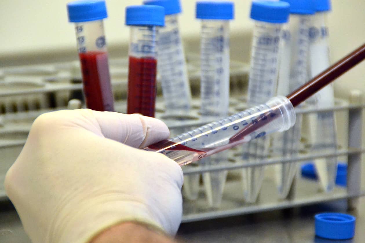 <hr>Séparation sur Ficoll sur le site CRB du Service d’hématologie biologique.