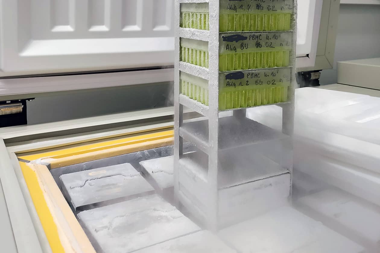<hr>Stockage des ressources biologiques à -20°C, -80°C et -150°C, avec surveillance des températures 24/24h.