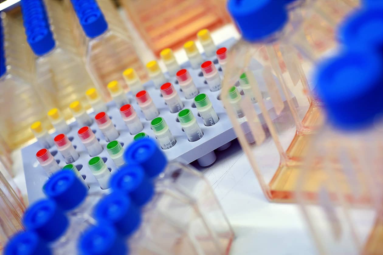 <hr>Cryotubes de PBMC.