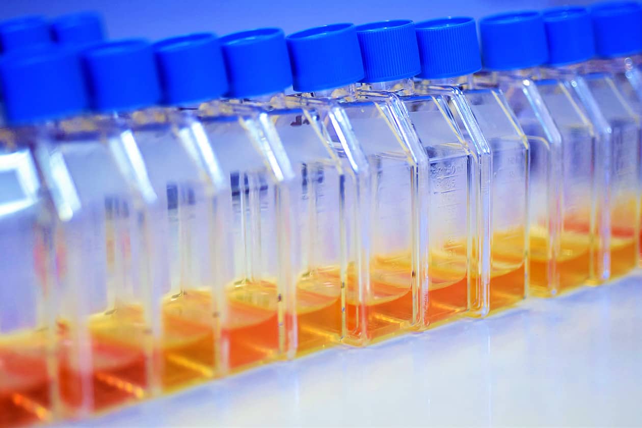 <hr>Lignées lymphoblastoïdes en culture.