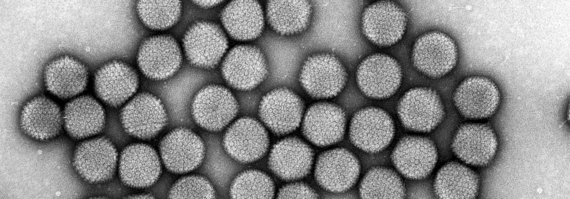 Microscope électronique à transmission - Neurophotonics Centre