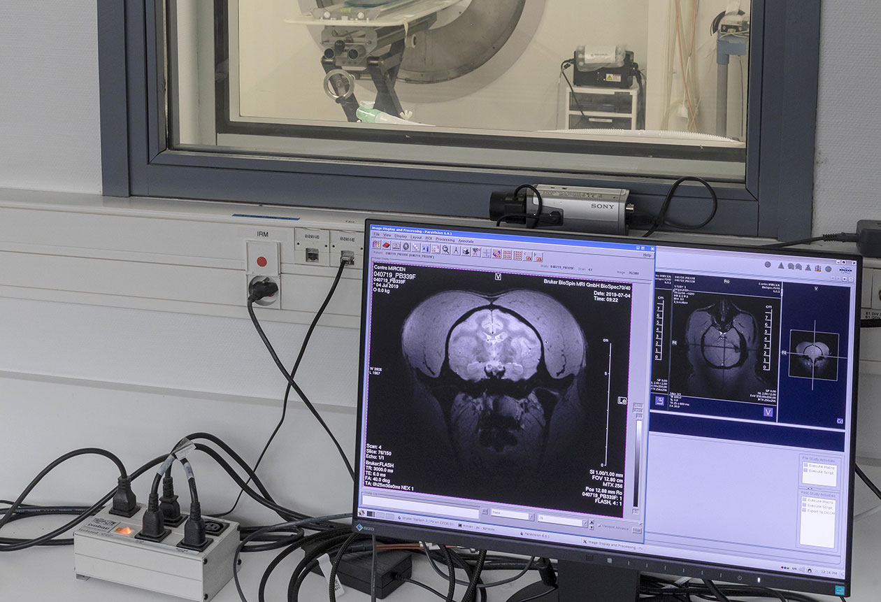 <hr>IRM 7T Bruker pour l’imagerie du système nerveux central.