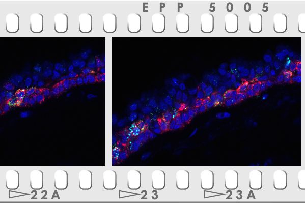 <hr>Détection par hybridation in situ (RNAscope) de kératine sur les sections successives d’un épithélium respiratoire humain. © IPMC, M-J. Arguel.