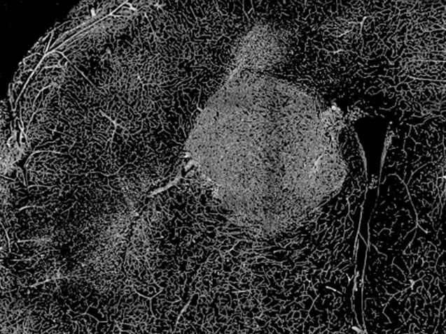 <hr>Microscopie à deux photons ex vivo de la vascularisation saine et tumorale dans un cerveau de souris (mosaïque en 3D).