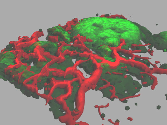 <hr>Microscopie à deux photons d’un gliome (GFP+) xénogreffe hétérotopique dans l’oreille d’une souris (mosaïque en 3D).