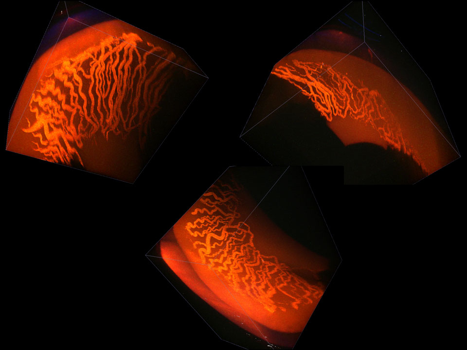 <hr>Microscopie à deux photons de la vascularisation rétinienne chez la souris en 3D.