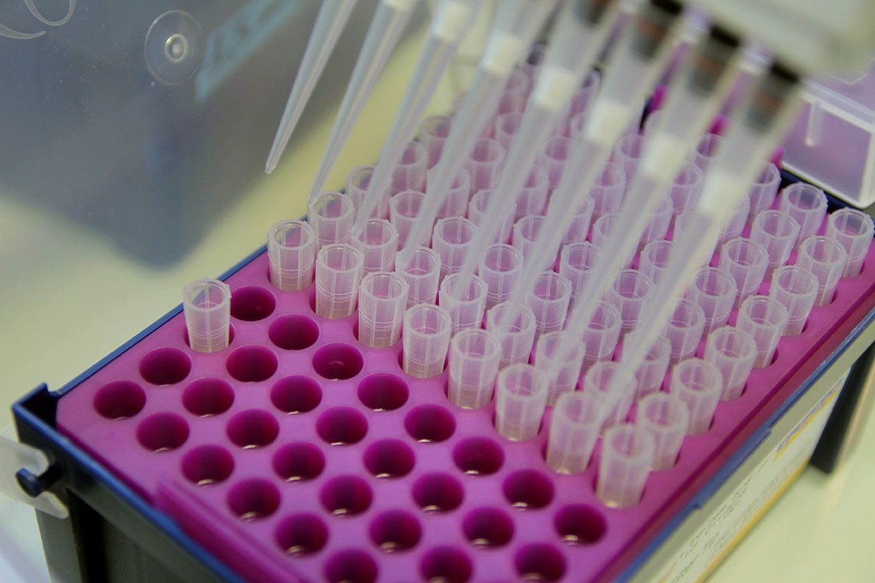 <hr>Cônes à filtres et pipette multicanaux.