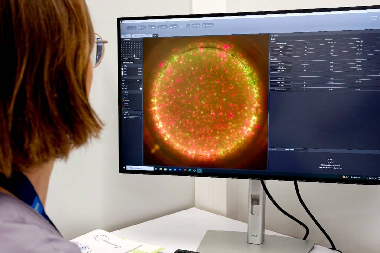<hr>Lecteur ELISpot et FluoroSpot pour l’évaluation des réponses immunitaires au niveau cellulaire (AniRA-ImmOs). © Inserm, V. Moncorgé.