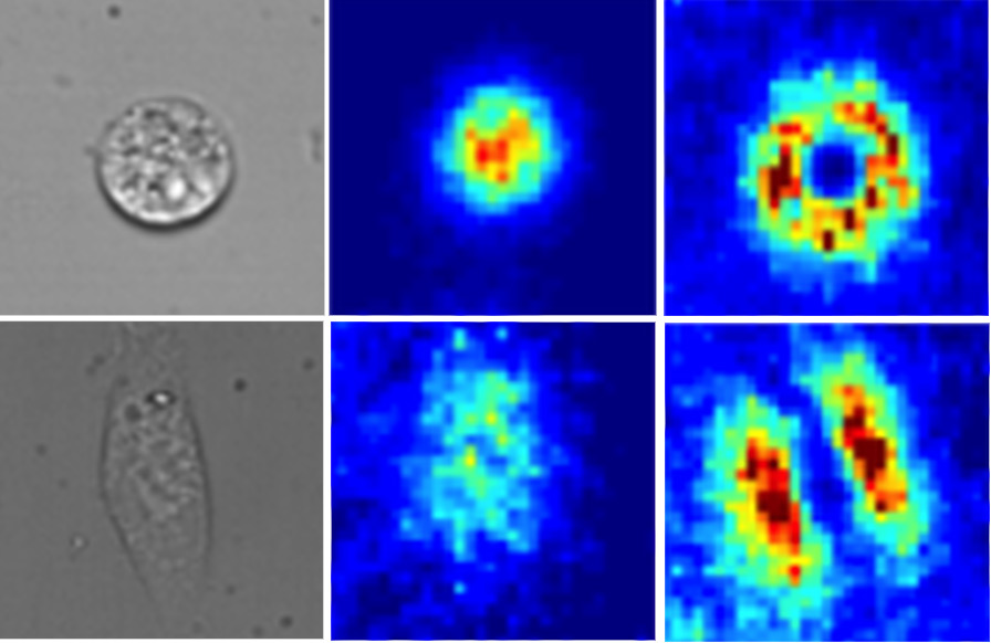 <hr>Empreintes laissées par des cellules individuelles (à gauche, en microscopie de phase) sur des mesures de concentration par RICS en fluorescence avec optique adaptative (à droite) et sans (au centre).