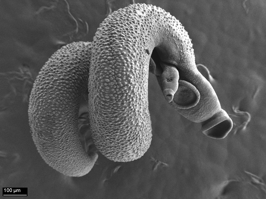 <hr>Couple de parasites schistosomes, MEB.