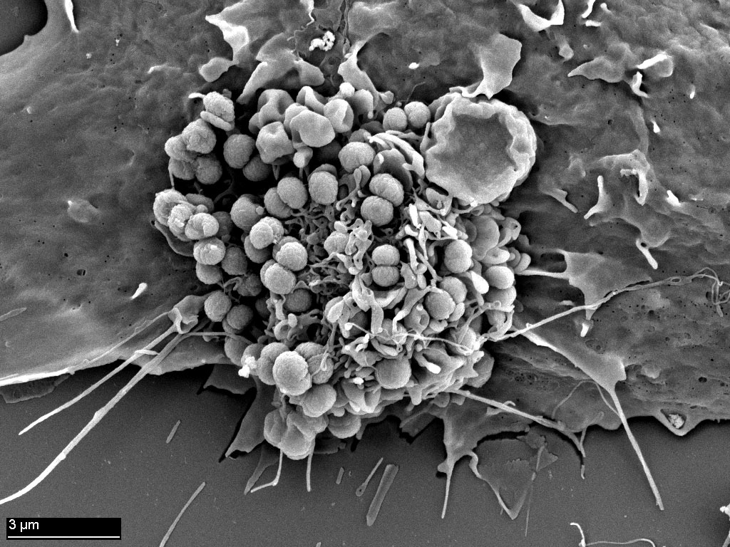 <hr>Neisseria meningitidis (méningocoque) à la surface d'une cellule, MEB.