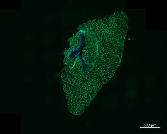 <hr>Analyse du muscle squelettique (laminine en vert). Echelle : 500 µm. © Institut Pasteur de Lille, A. Mayeuf-Louchard, A. Danckaert.