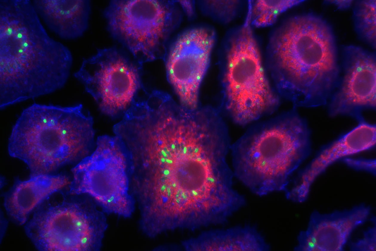 <hr>Cellules HeLa infectées par S. flexneri exprimant la protéine GFP. Marquage après fixation avec la filipine (en bleu) et immunomarquage avec un anticorps anti-BL (en rouge).