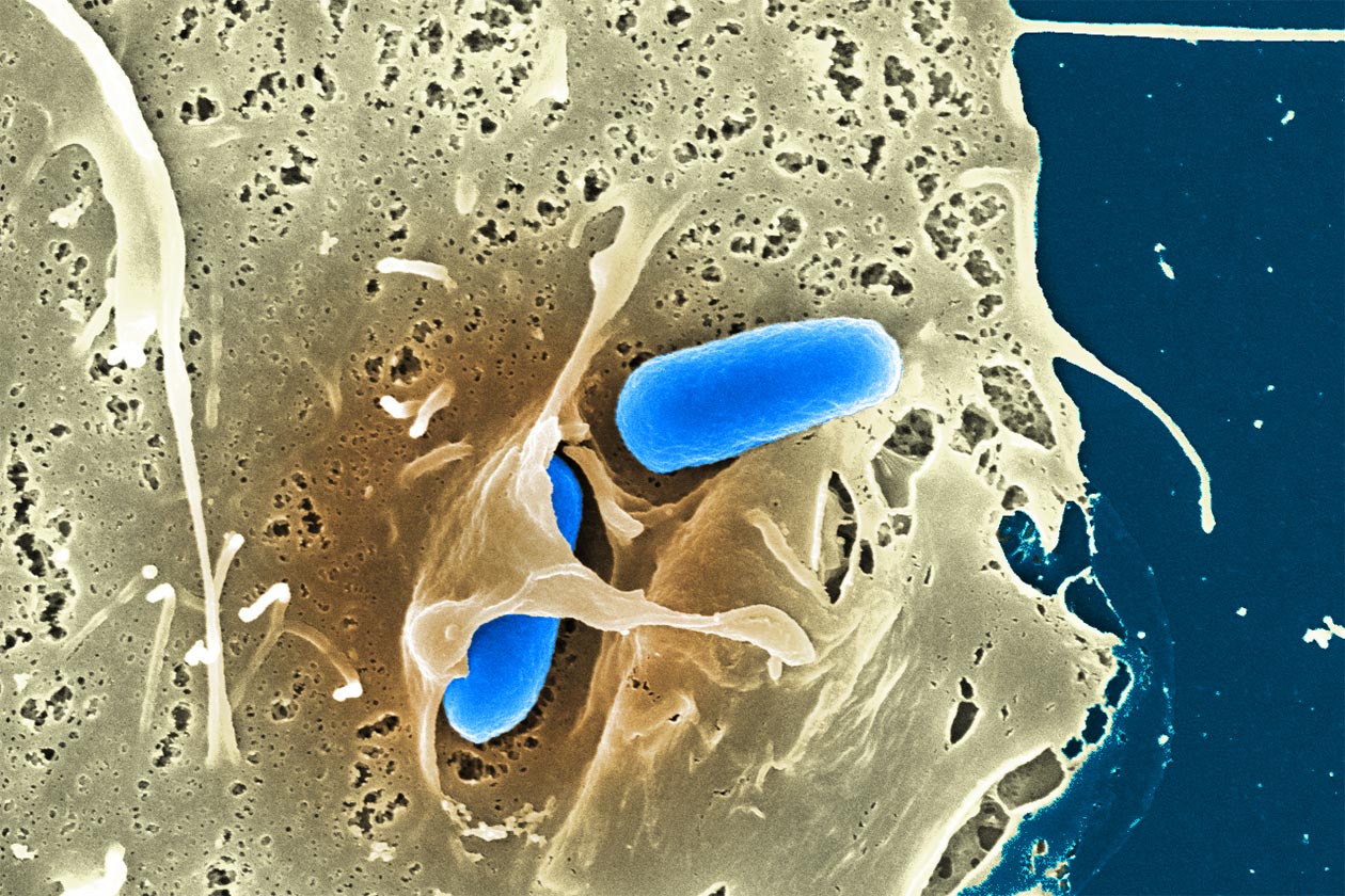<hr>Cellule HeLa infectée par Y. pseudotuberculosis et observée en microscopie électronique à balayage (fausses couleurs). © CMIP.