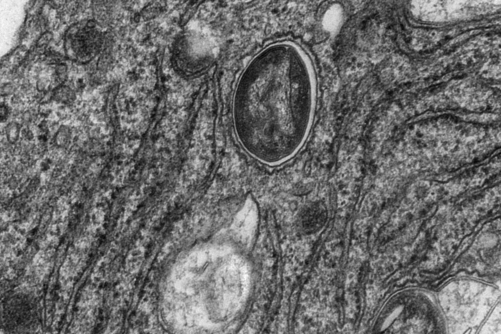 <hr>Macrophage infecté par M. tuberculosis et observé en MET.
