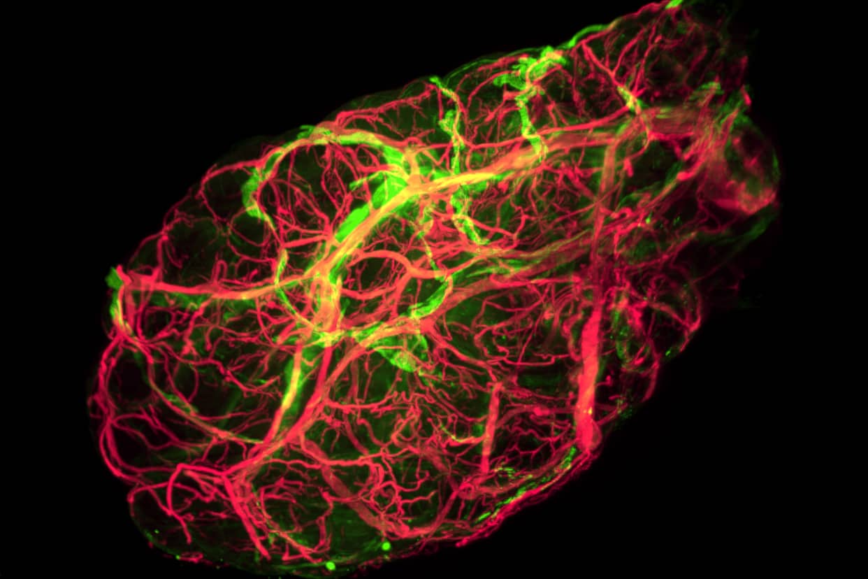 <hr>Vue 3D complète de la vascularisation épididymaire chez la souris. © Inserm, C. Damon-Soubeyrand.