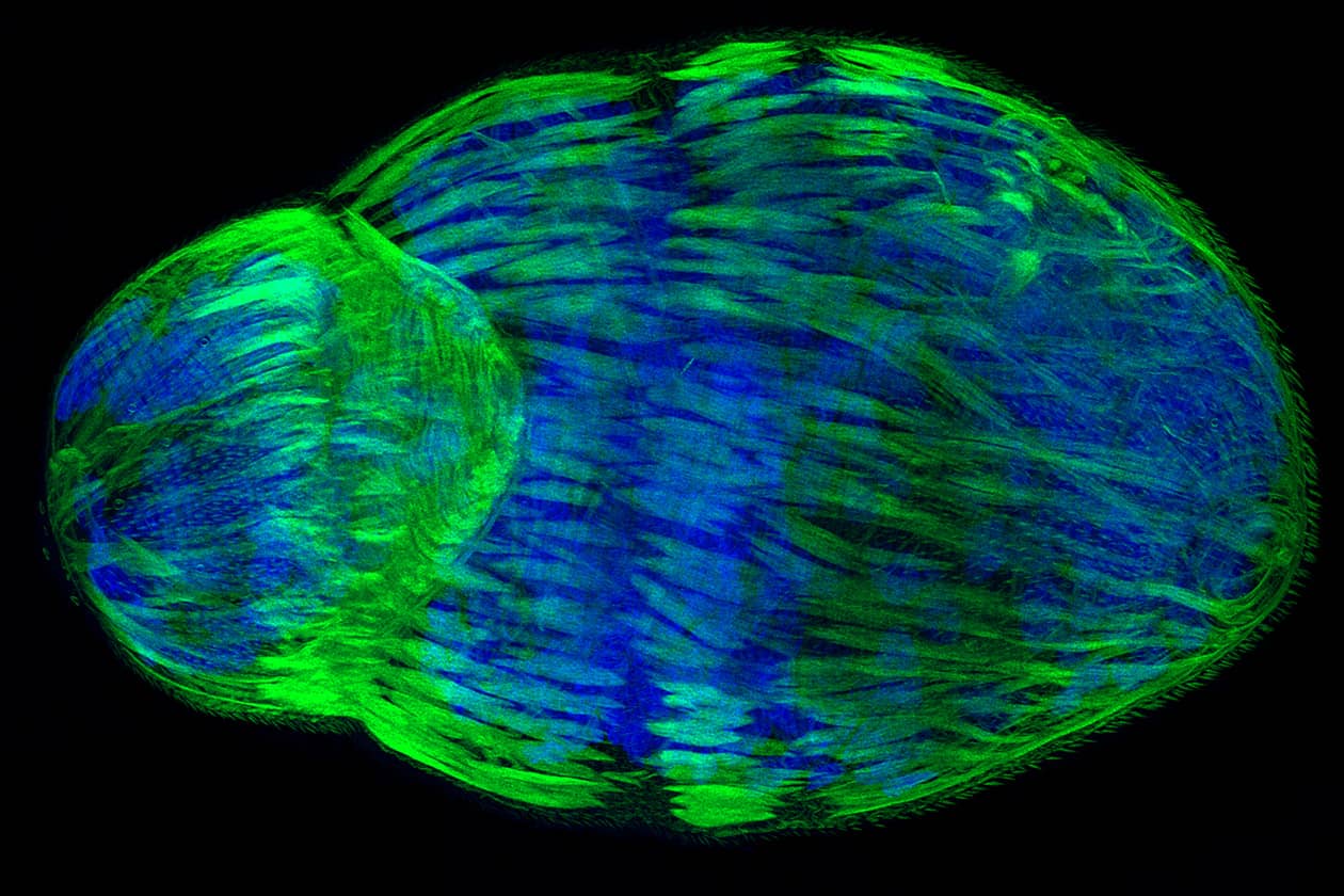 <hr>Image 3D d’un schistosomule obtenue par microscopie confocale à haute résolution. © IPL, J. Vicogne.