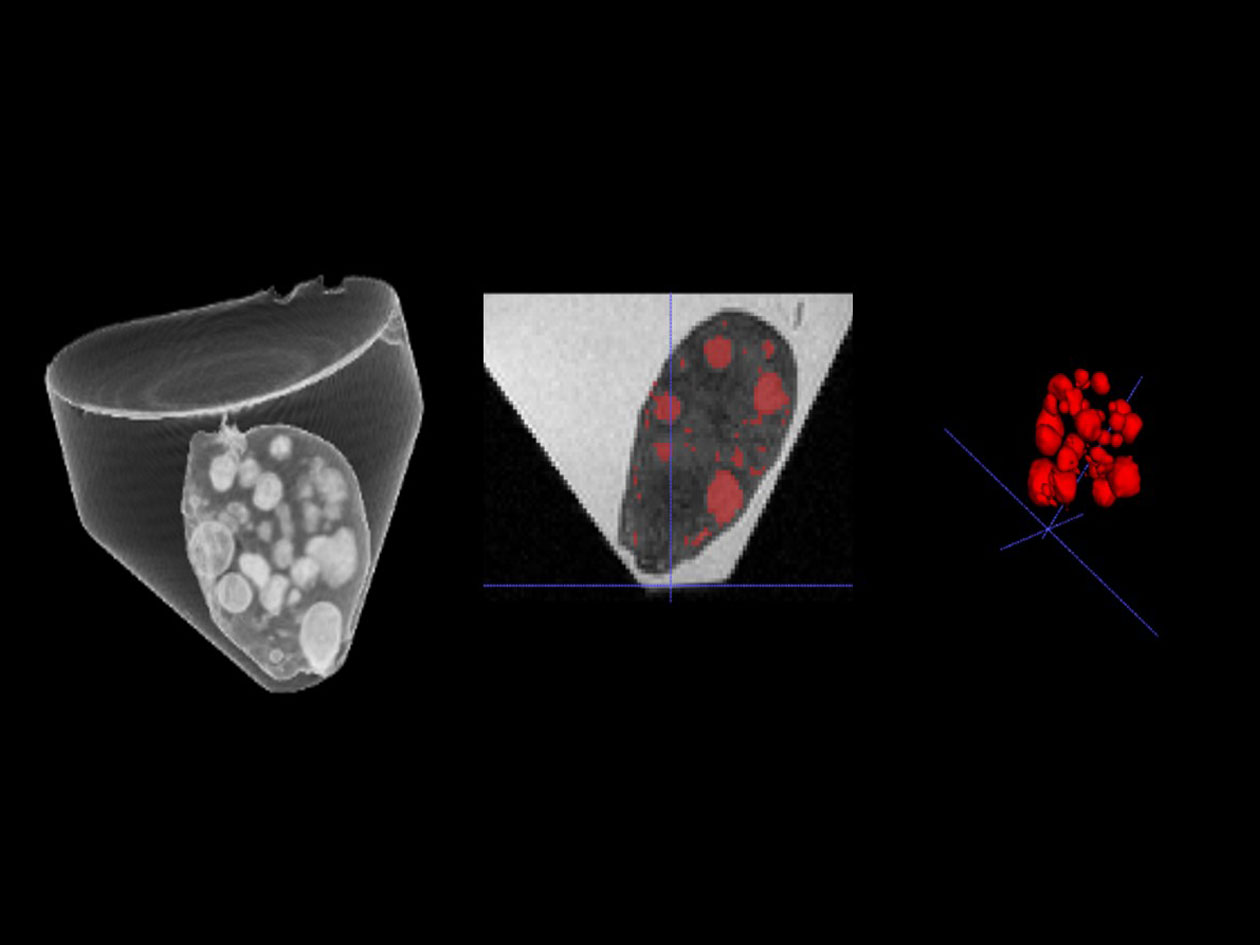 <hr>Imagerie IRM 3D d’un follicule ovarien de brebis ex vivo (à gauche), segmentation des différents follicules dans l’ovaire (au milieu) et modélisation 3D des follicules (à droite).