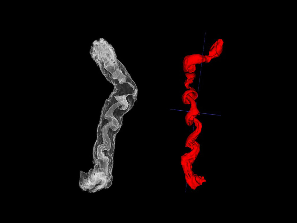 <hr>Visualisation en 3D d'un col d’utérus de brebis à partir d’une séquence anatomique en IRM (à gauche) et modélisation en 3D après segmentation du canal central de l'organe (à droite).