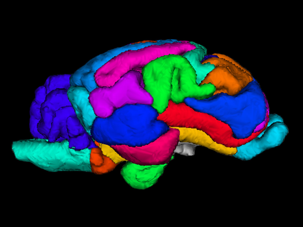 <hr>Création d’un atlas de cerveau de brebis après segmentation en IRM, permettant une meilleure identification et visualisation en 3D des différentes structures.