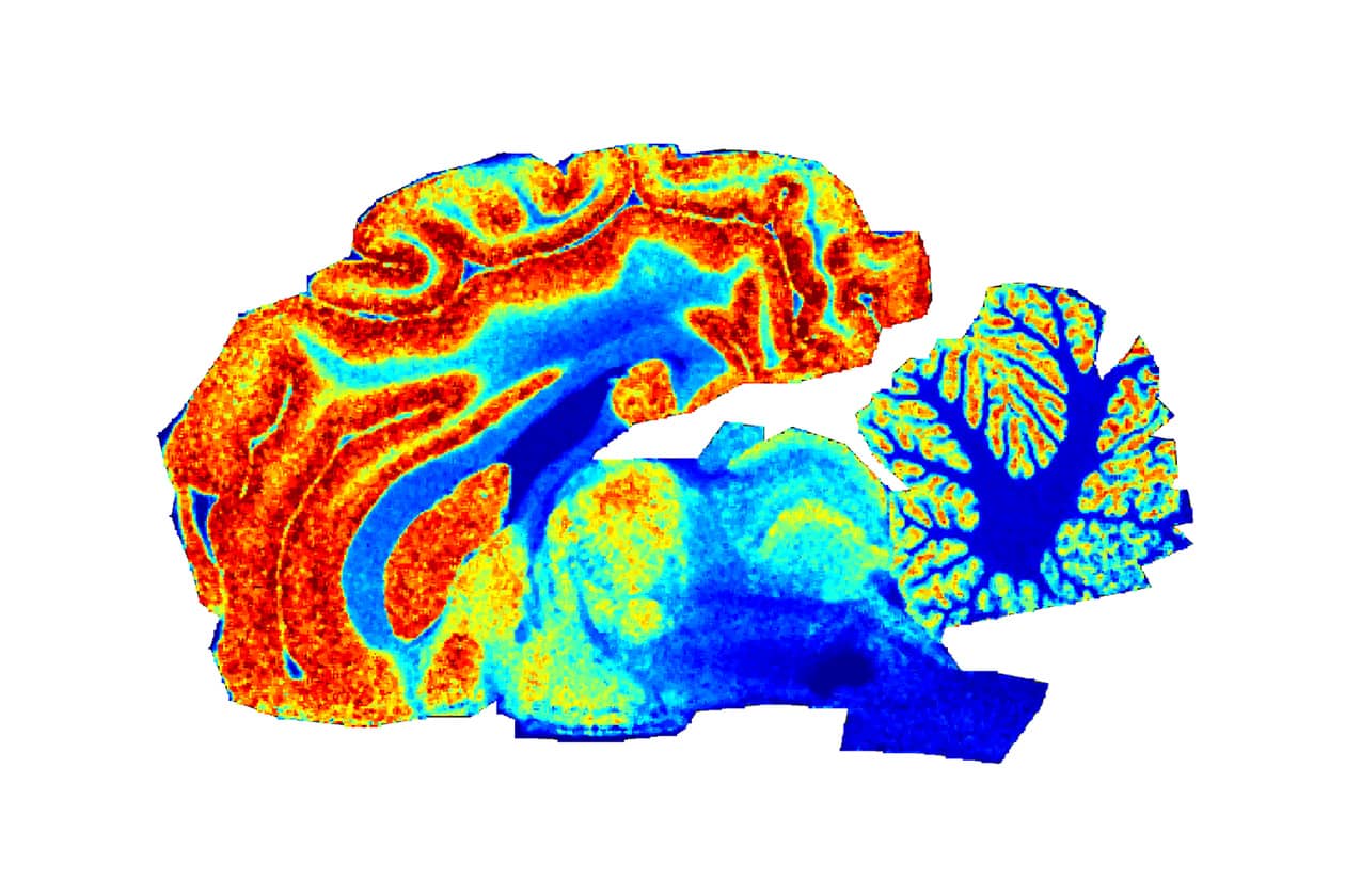 <hr>Imagerie moléculaire lipidique MALDI-TOF d’une coupe entière de cerveau de brebis : carte de densité ionique à 772 m/z.