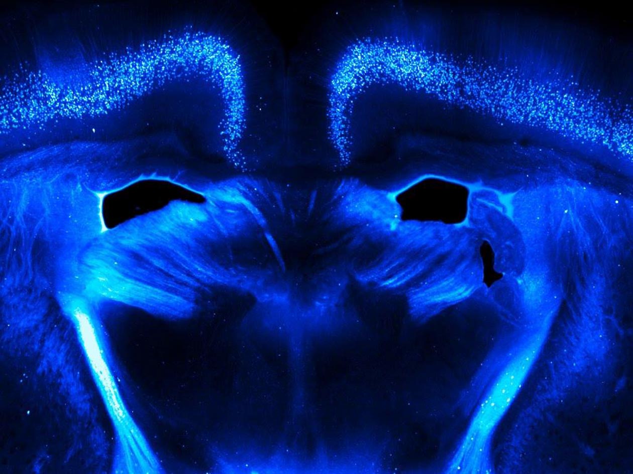 <hr>Section coronale de cerveau de souris YFP Thy-1. © L. Nikita, iBV, Nice.